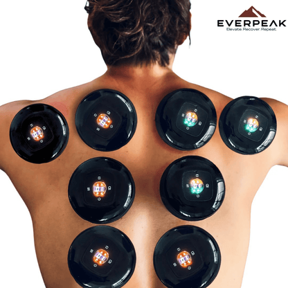 DeepWave™ - Smartes Schröpfgerät